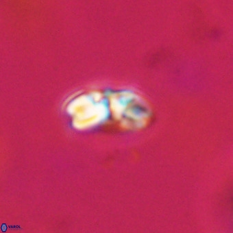 Watznaueria angustoralis VR 23861