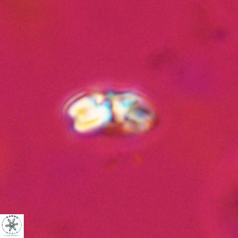 Watznaueria angustoralis VR 23861