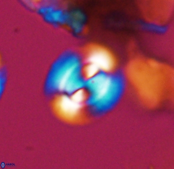 Watznaueria arata 9082