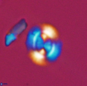 Watznaueria arata 13105