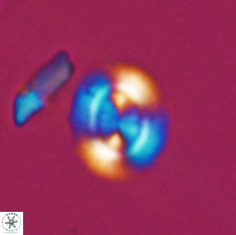 Watznaueria arata 13105