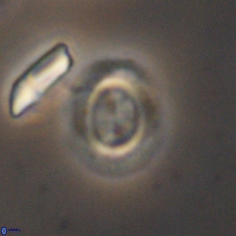 Watznaueria arata 13109