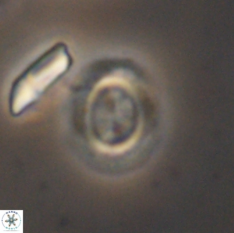 Watznaueria arata 13109