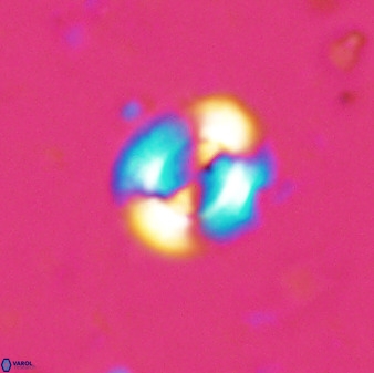 Watznaueria arata 34859