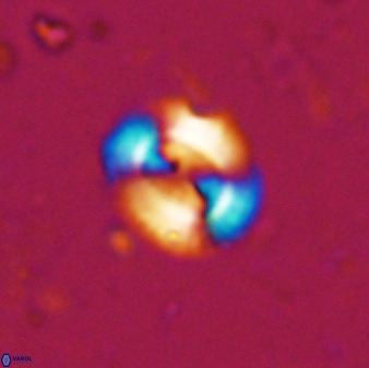 Watznaueria arata 34865