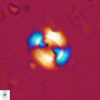 Watznaueria arata 34865
