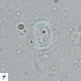 Watznaueria arata 34868