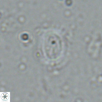 Watznaueria arata 34869