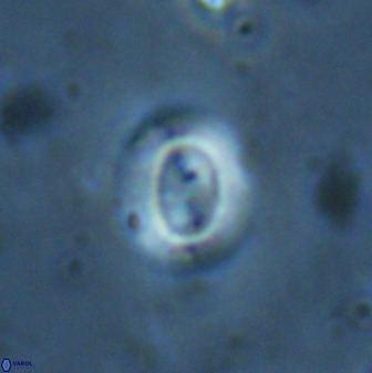 Watznaueria arata 34870