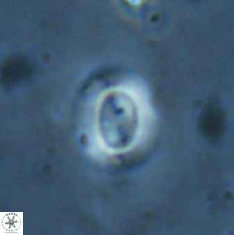 Watznaueria arata 34870