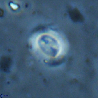 Watznaueria arata 34871