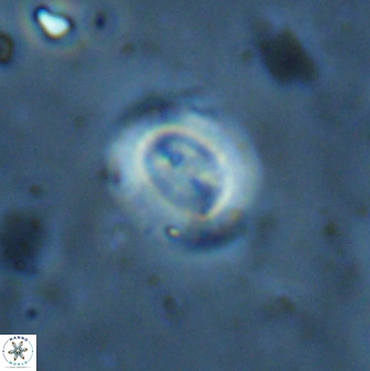Watznaueria arata 34871
