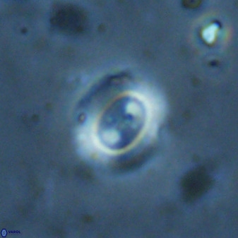 Watznaueria arata 34872