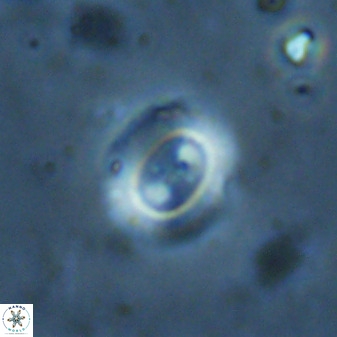 Watznaueria arata 34872