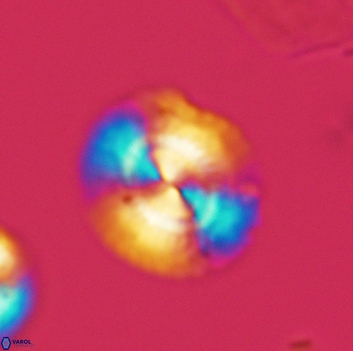 Watznaueria arata 3666