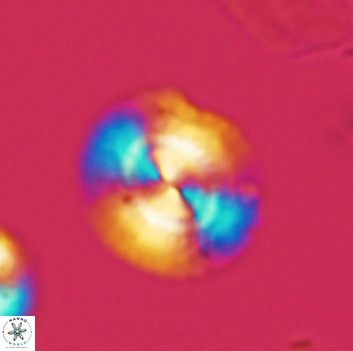 Watznaueria arata 3666