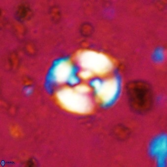 Watznaueria barnesiae VR 20301