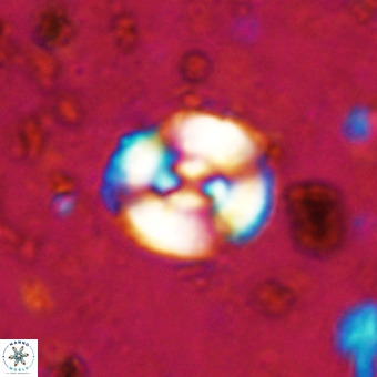 Watznaueria barnesiae VR 20301