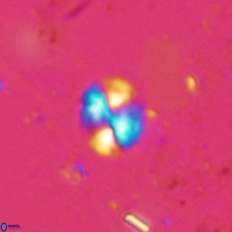 Watznaueria bayackii 42434