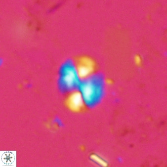 Watznaueria bayackii 42434