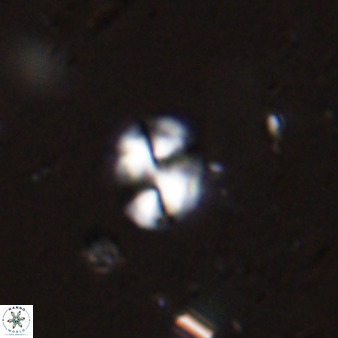 Watznaueria bayackii 42435