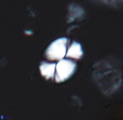 Watznaueria bayackii 11640