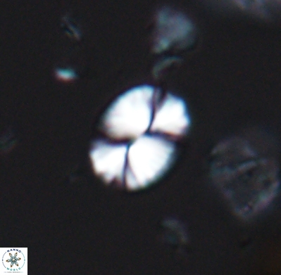 Watznaueria bayackii 11640