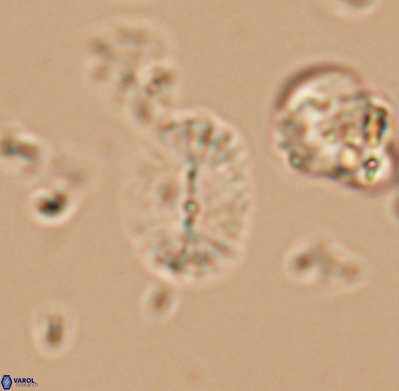 Watznaueria bayackii 11641