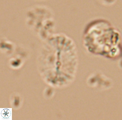 Watznaueria bayackii 11641