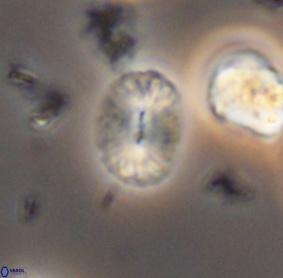 Watznaueria bayackii 11642