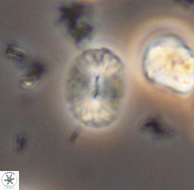 Watznaueria bayackii 11642