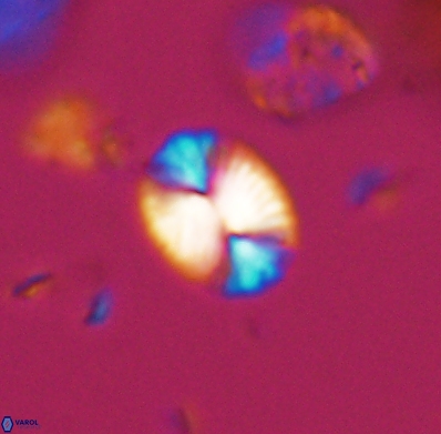 Watznaueria bayackii 11632