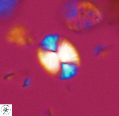 Watznaueria bayackii 11632
