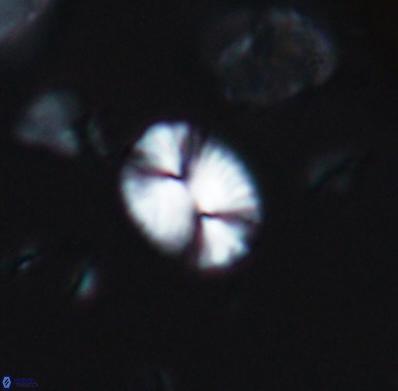 Watznaueria bayackii 11633