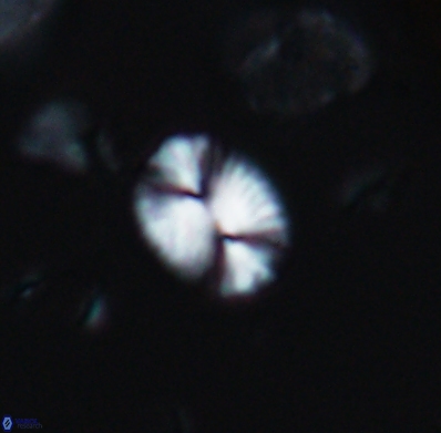 Watznaueria bayackii 11634
