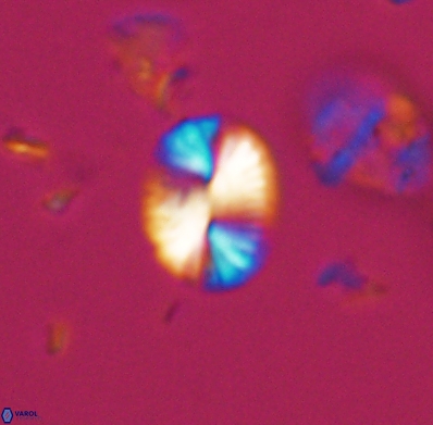 Watznaueria bayackii 11636