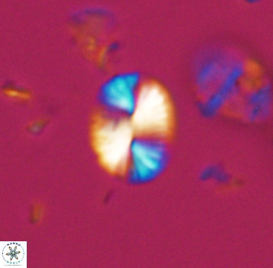 Watznaueria bayackii 11636