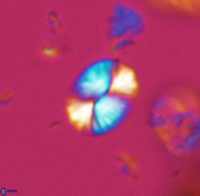 Watznaueria bayackii 11639
