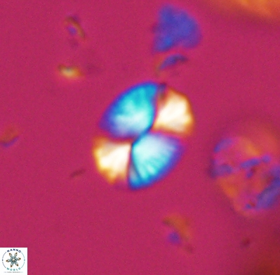 Watznaueria bayackii 11639