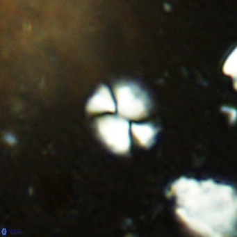Watznaueria bayackii VR 14302