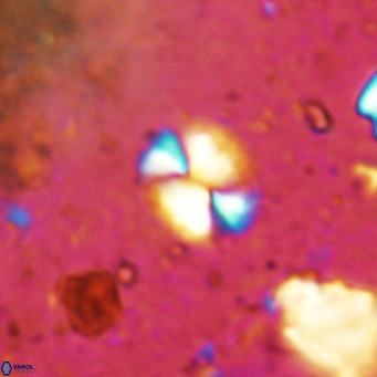 Watznaueria bayackii VR 14303