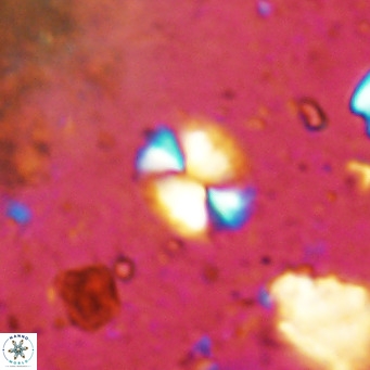 Watznaueria bayackii VR 14303