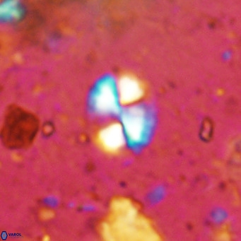 Watznaueria bayackii VR 14304