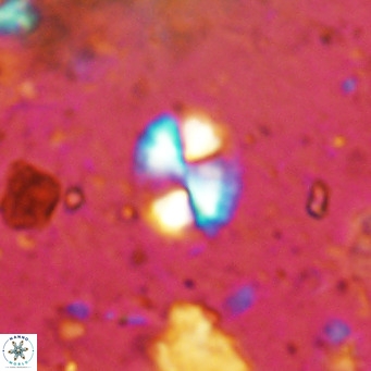 Watznaueria bayackii VR 14304