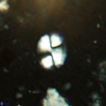Watznaueria bayackii VR 14305