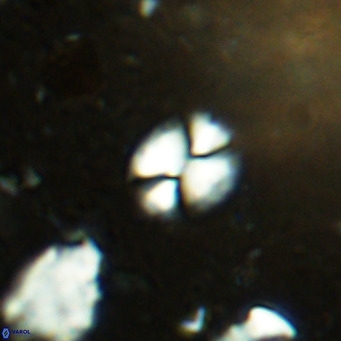 Watznaueria bayackii VR 14306