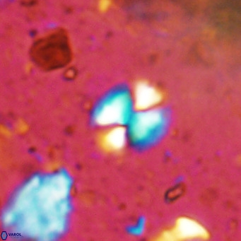Watznaueria bayackii VR 14307