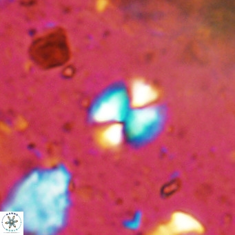 Watznaueria bayackii VR 14307