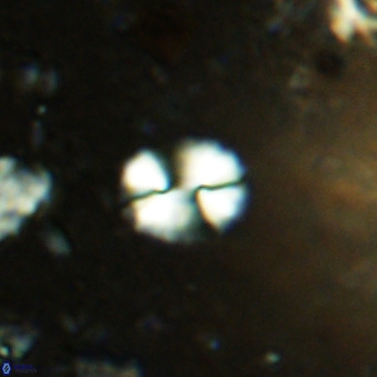 Watznaueria bayackii VR 14309