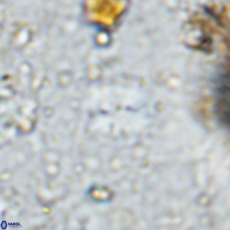 Watznaueria bayackii VR 14312